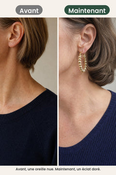 [fr] Créoles dorées à petites boules – avant, une oreille nue. Maintenant, un éclat doré